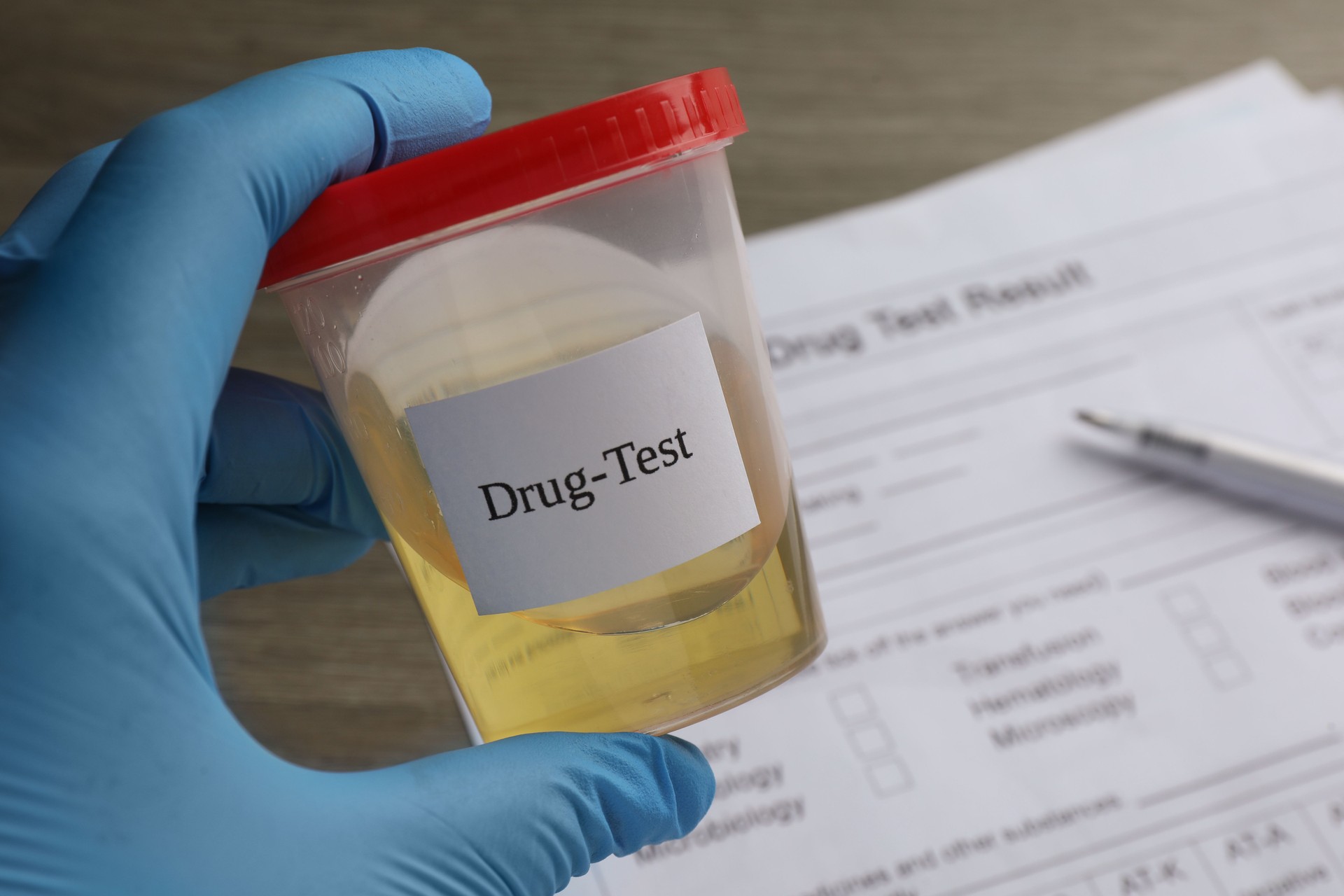 Drug test. Laboratory worker holding container with urine sample at table, closeup
