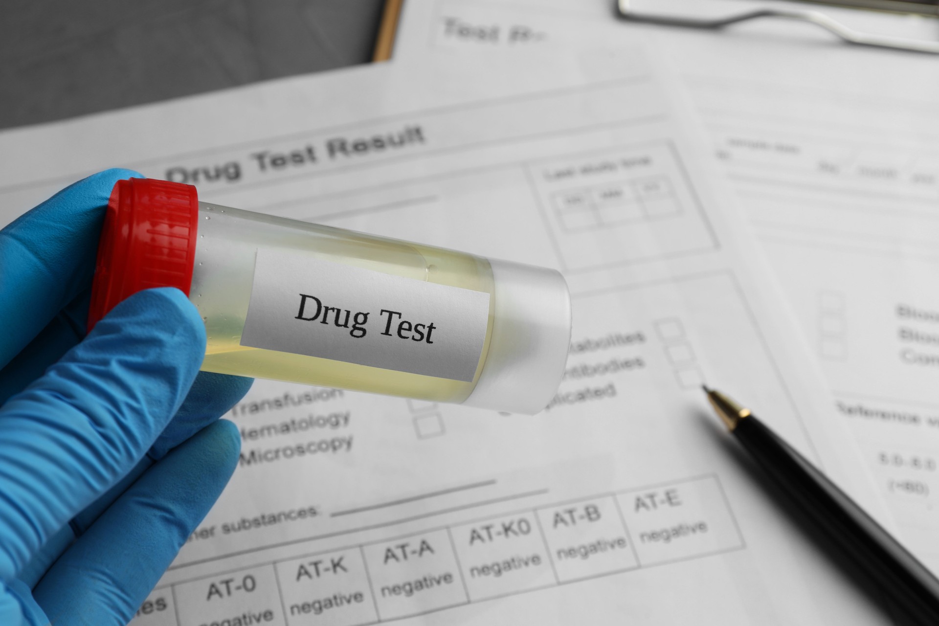 Drug test. Laboratory worker holding container with urine sample over medical forms on table, closeup